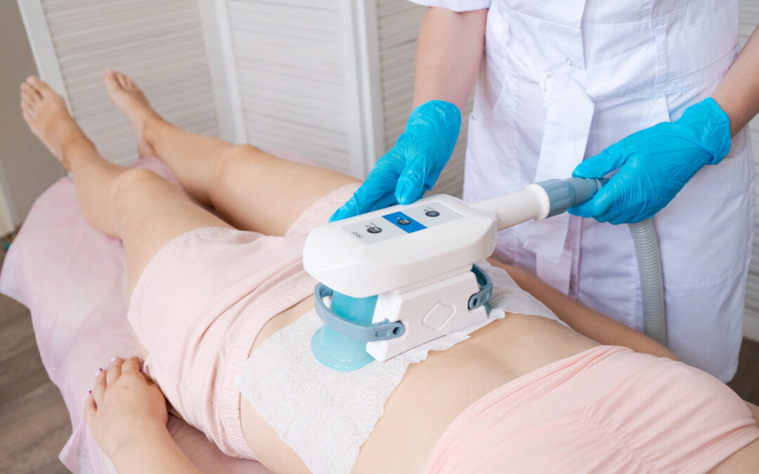 CoolSculpting