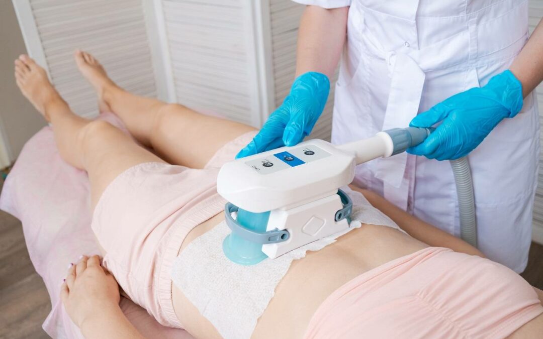 Coolsculpting procedure