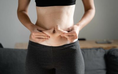 CoolSculpting Recovery 101: Important Tips to Know