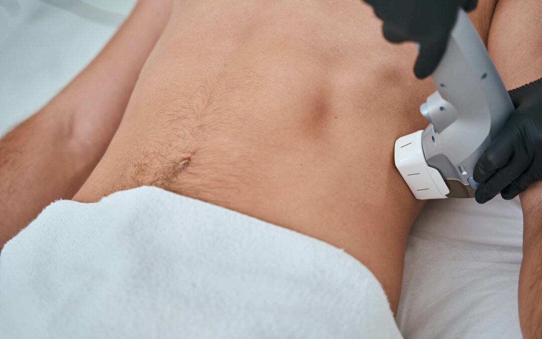 coolsculpting procedure