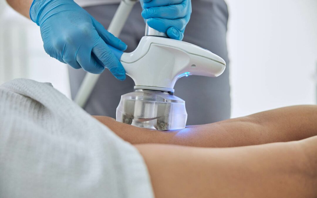 coolsculpting