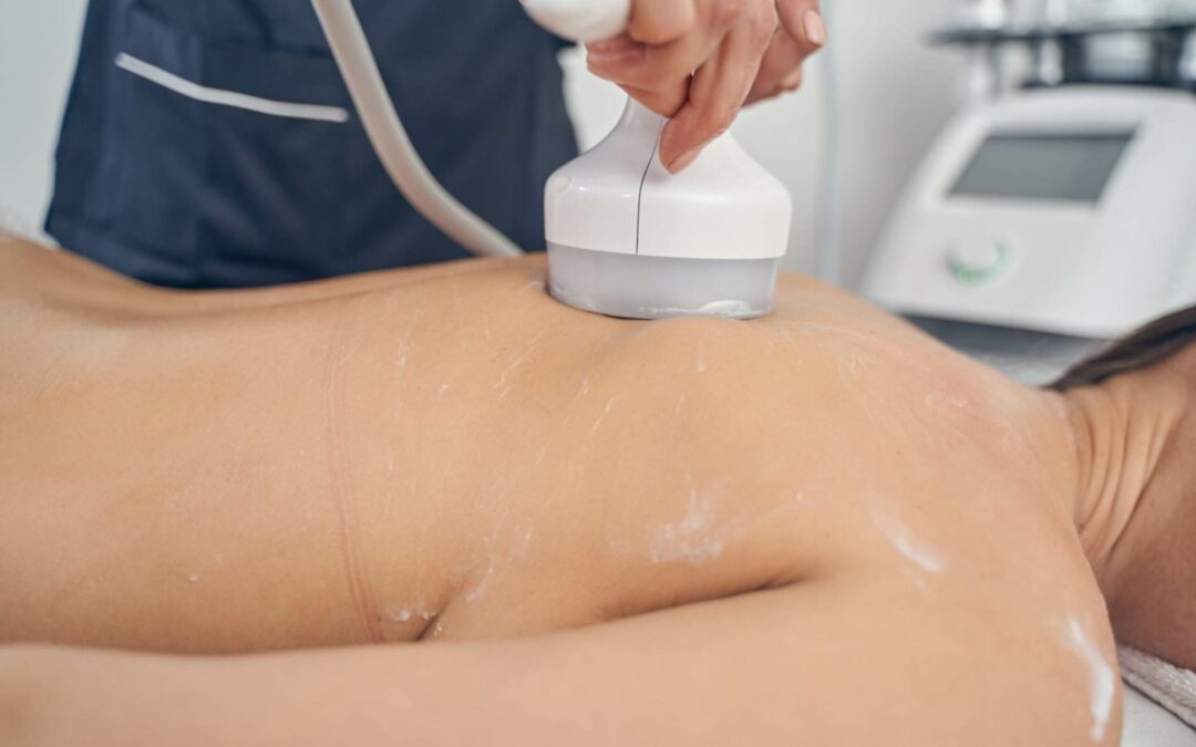 Defy the Aging Process with CoolSculpting: A Guide to Body Contouring