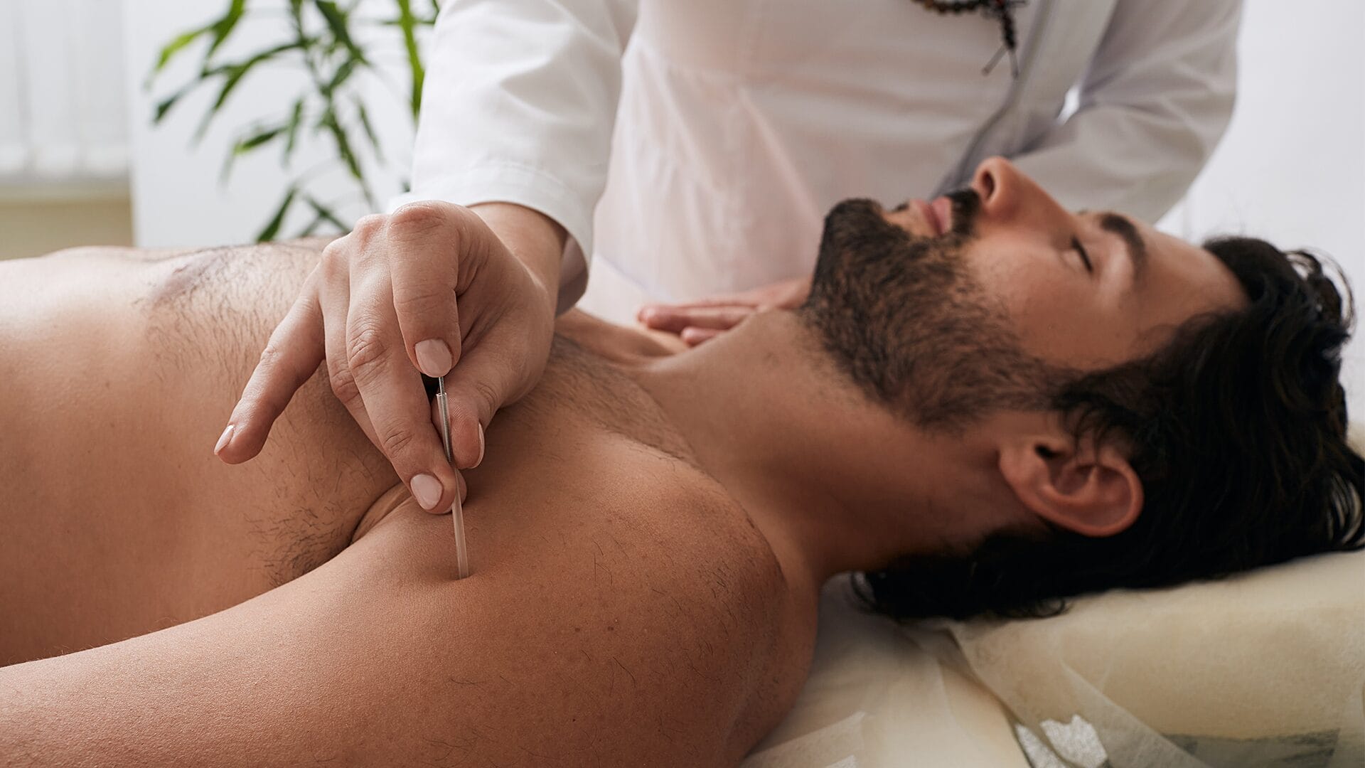 Acutrigger 2 Male patient laying down during acupuncture and acutrigger therapy.