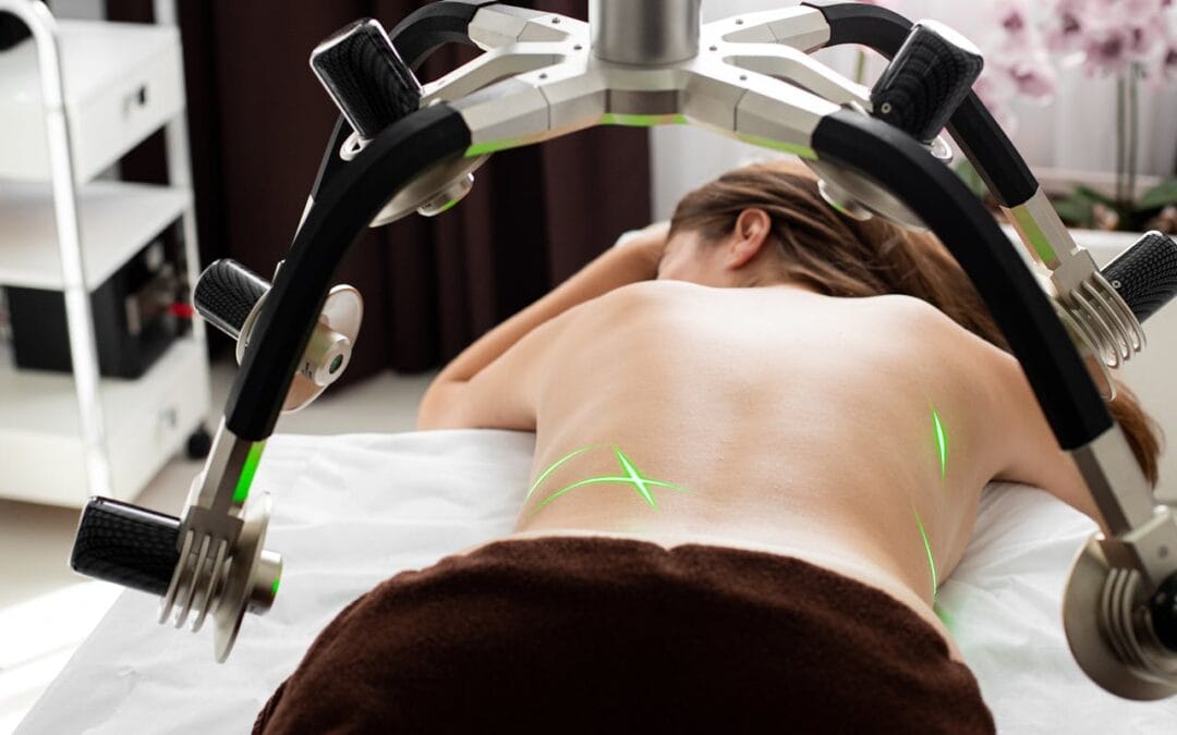 CoolSculpting Options