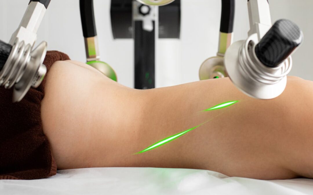 CoolSculpting