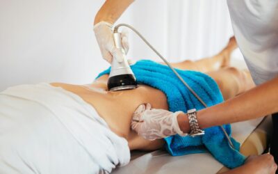 CoolSculpting Advantages in Chula Vista