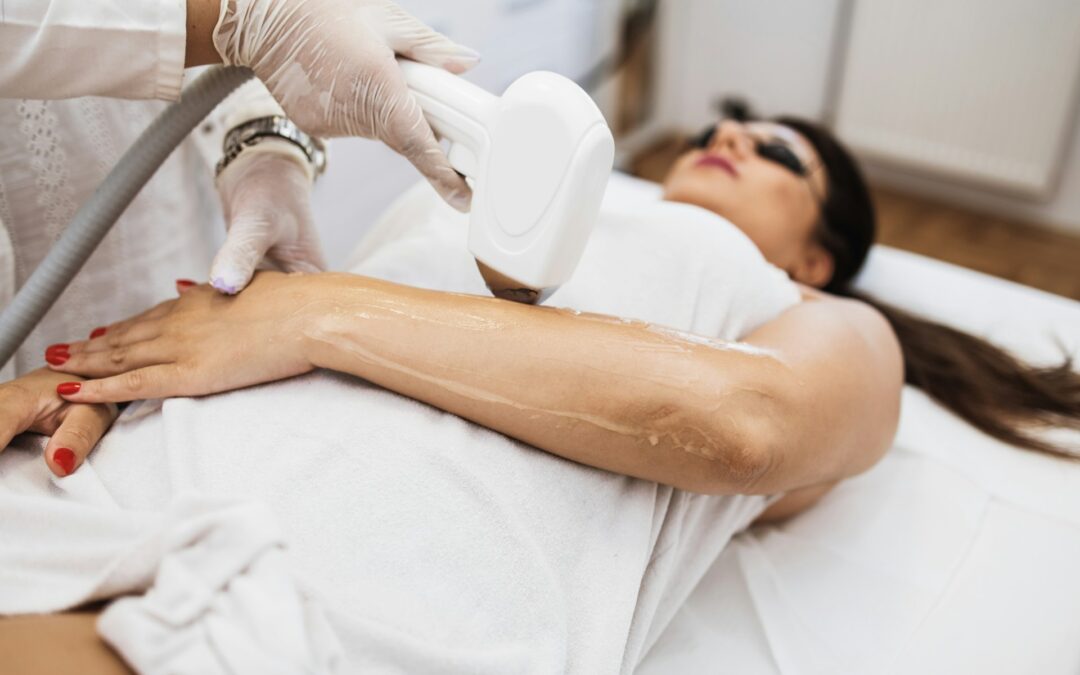 CoolSculpting Results