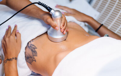 How Emsculpt Transforms Your Body